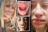 Mum shares horrifying pics of Turkey teeth op gone wrong to warn others