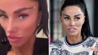 Katie Price reveals eyebrows are peeling OFF after getting them lasered