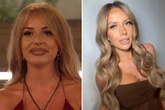 Inside the celeb glow-down trend as they get filler dissolved