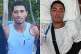Jude Bellingham shows off huge scar after Real Madrid star's shoulder surgery