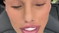 Katie Price shows off her post-surgery scars after ripping out her stitches