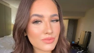Millions laughed at my £3.6k Turkey teeth… I don't care, I want to look fake