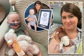 World's most premature baby born at 21 weeks defies odds to reach 1st birthday