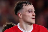 Middlesbrough star forced off with huge egg on eye after sickening head clash