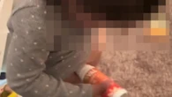 Mum on Mounjaro slated as toddler pretends to inject herself with fat jabs