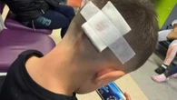 MAFS star rushes son to A&E after football accident & shares pics from hospital