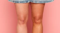 £3 ‘Ozempic tan’ which will take 5lbs off your thighs... Four mums test options