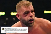 Canelo's coach sends message to Billy Joe Saunders after Brit has surgery