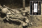 Skeleton of oldest SHARK victim with missing leg found after 3,000 years