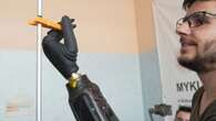 Incredible footage shows world's first prosthetic hand controlled by magnets