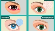 From thinning brows to floaters – the health warnings hidden in your eyes revealed