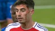 Havertz left covered in blood as head wound opens up as Arsenal face Chelsea