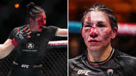 Fans gasp 'is that her brain' as fighter suffers 'worst cut in UFC history'