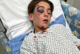 I'm sharing upsetting pic of son after driver ploughed into him 'in revenge'