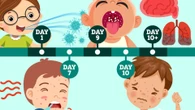 Measles timeline revealed - all symptoms of the disease after child dies in UK
