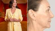 Strictly's Shirley Ballas reveals results of new facelift