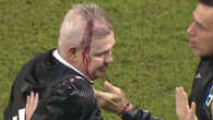 Mexico boss left with blood pouring down face after being hit with beer can