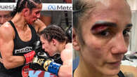 Amanda Serrano shows gruesome gaping wound above her eye after Katie Taylor loss