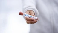 Могут ли вузы обязать непривитых студентов сдавать ПЦР-тесты за свой счет, ответили в МОН