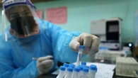 Ровно 1000 случаев заражения коронавирусом выявили за сутки в Казахстане