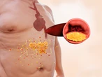 Nie udaje ci się obniżyć poziomu cholesterolu? Wypróbuj tych 5 sposobów niezwiązanych z dietą