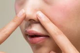 Czym jest sebum? Podpowiadamy, jak ograniczyć nadmiar sebum