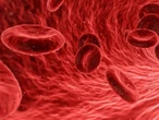 Sukces polskich hematoonkologów. Zmienią światowy standard leczenia szpiczaka?