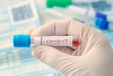 Darmowy test na badanie przeciwciał SARS-COV-2. Projekt badawczy szuka chętnych
