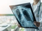 Pulmonolog: Jesteśmy oblężeni pacjentami. A ci są rozżaleni i przerażeni