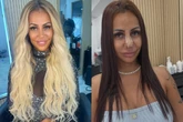 Influencer revela que refez harmonização facial após dica do ChatGPT
