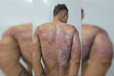 “Auxiliar de acusação” do tribunal do crime virou réu e levou pauladas