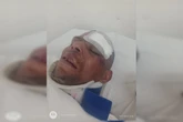 Vídeo: ciclista quase perde o braço ao ser atropelado por ônibus no DF