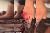 Tribunal do crime: ladrão tem dedo cortado por faccionado do CDC. Veja