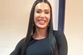 Foto: Gracyanne Barbosa choca ao mostrar cicatriz no joelho