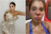 Influencer é torturada por horas e tem rosto desfigurado em assalto
