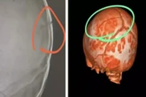 Tia de bebê que caiu em creche e fraturou o crânio cobra respostas