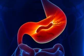 Médico cita qual suplemento atua contra a H. pylori e como consumi-lo