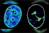 Imagens mostram como o vírus da herpes altera as células humanas