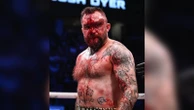 Imagens fortes: boxeador publica foto do rosto cortado após luta
