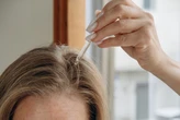 “Mminoxidil natural”: óleo vegetal é usado contra queda de cabelo