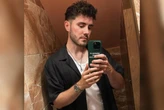 Youtuber descobre distúrbio digestivo raro após uma década com refluxo