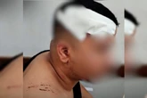 “Mão de Ferro”: jovem é agredido com paulada em partida de truco em GO