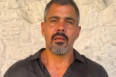 Após cirurgia, Juliano Cazarré faz fisioterapia e revela hematomas