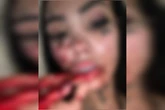 Influencer brasiliense mostra onde levou 9 facadas do ex durante live
