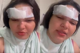 Cantora tem testa cortada por garrafa em briga motivada por ciúmes