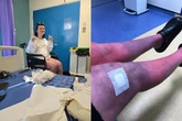 Após dar à luz, mãe é diagnosticada com doença que “incendeia” a pele