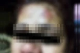 Fotos: homem esfaqueia mulher e fere filho de 3 anos com facada na mão