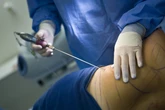 Inverno favorece cirurgias plásticas e acelera recuperação, diz expert