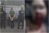 Homem é preso após desfigurar rosto de companheira enquanto dormia