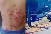Guardas flagrados torturando motociclista rendido viram réus